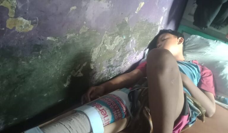 Siswa SMPN di Cilamaya Wetan Tertimpa Plafon Sekolah, Orang Tua Minta Tanggung Jawab hingga Sembuh